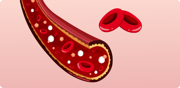 tab-cordblood-type-01.png