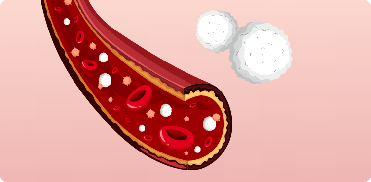 tab-cordblood-type-02.png